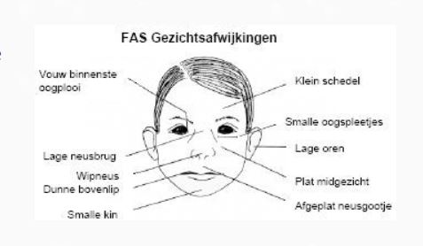 Hulpverleners aan het woord over het foetaal alcohol syndroom